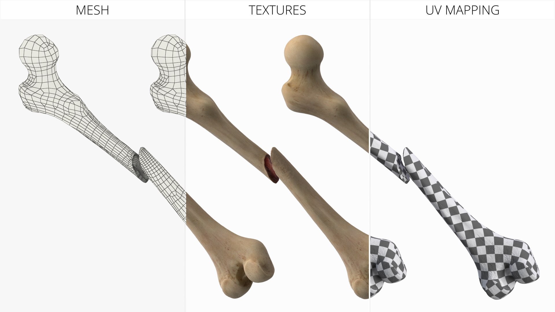3D Femur Bone with Complete Fracture https://p.turbosquid.com/ts-thumb/9W/uOJLFo/6c/femur_bone_with_complete_fracture_008/jpg/1782799959/1920x1080/fit_q87/12852b851427a09d629aae93d09c957a56ce328b/femur_bone_with_complete_fracture_008.jpg