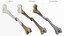 Femur Bone with Complete Fracture