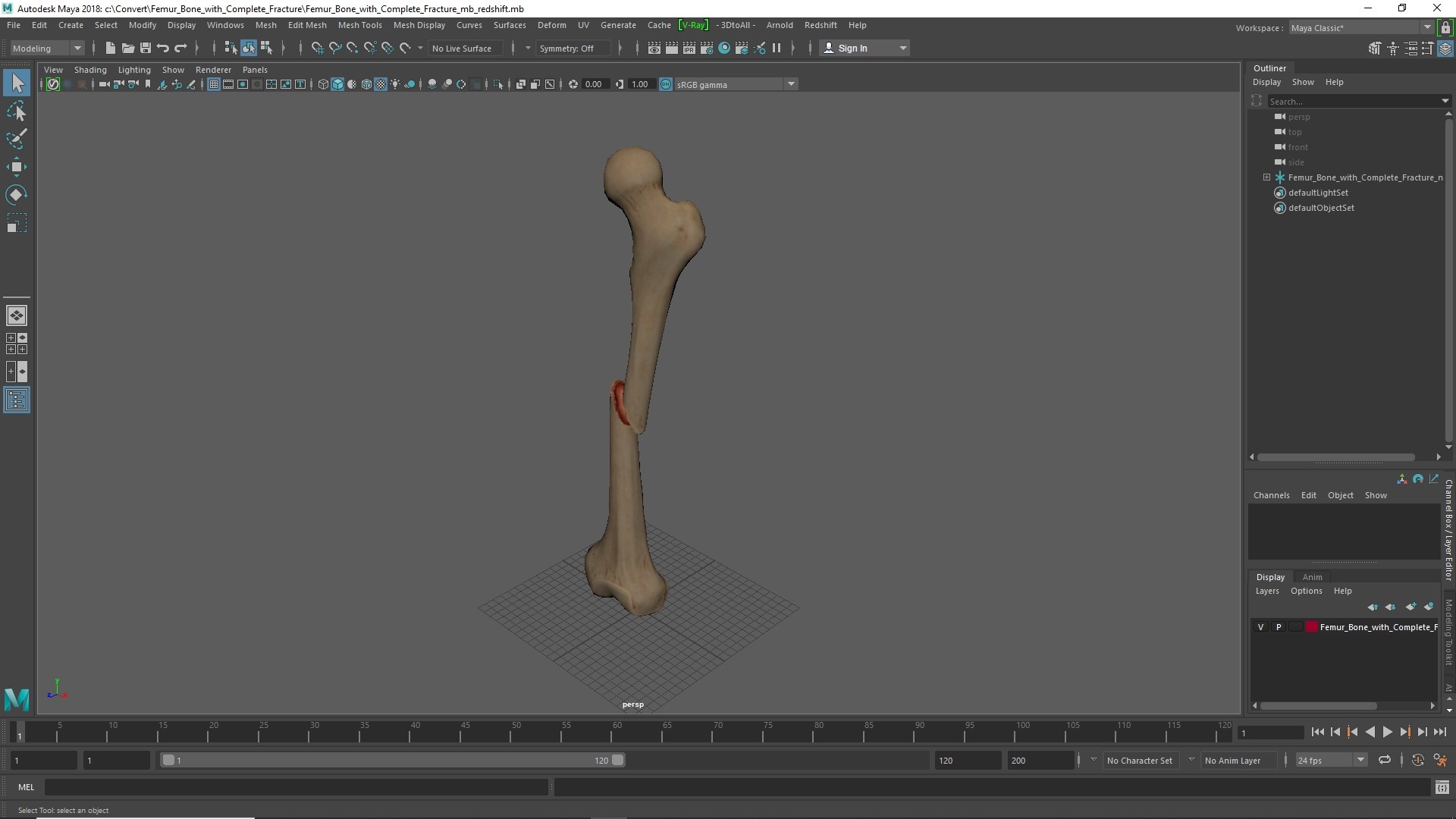 3D Femur Bone with Complete Fracture https://p.turbosquid.com/ts-thumb/9W/uOJLFo/BL/femur_bone_with_complete_fracture_1002/jpg/1782799980/1920x1080/fit_q87/abf0b99238bce6c6c4ee935f0bcde7bed4eaa9be/femur_bone_with_complete_fracture_1002.jpg