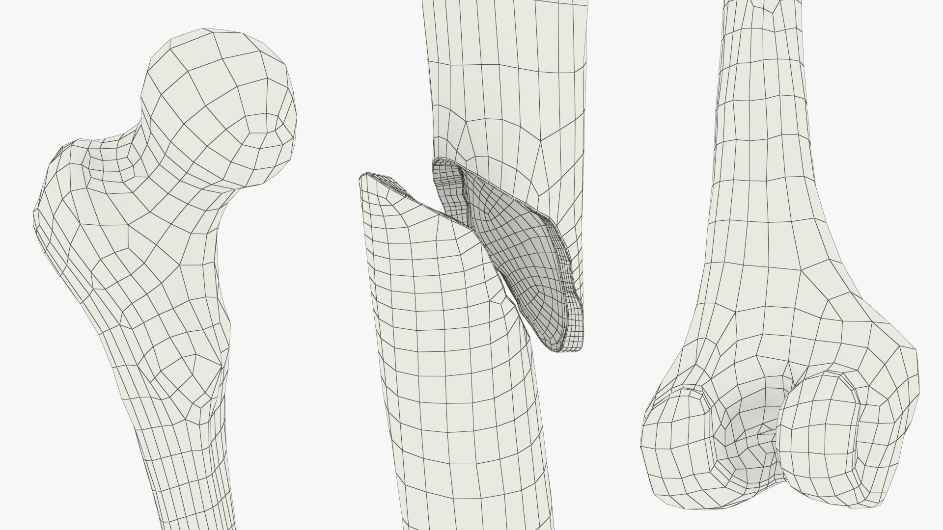3D Femur Bone with Complete Fracture https://p.turbosquid.com/ts-thumb/9W/uOJLFo/Ba/femur_bone_with_complete_fracture_011/jpg/1782799967/1920x1080/fit_q87/83d6cb4dbe12e2b22b3a46900a47e4e021eb5272/femur_bone_with_complete_fracture_011.jpg