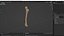 Femur Bone with Complete Fracture