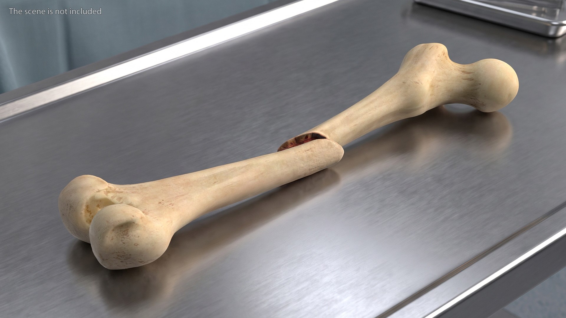 3D Femur Bone with Complete Fracture https://p.turbosquid.com/ts-thumb/9W/uOJLFo/Jn/femur_bone_with_complete_fracture_002/jpg/1782799897/1920x1080/fit_q87/4500863e5db21654fb77f81fb581935c8500283c/femur_bone_with_complete_fracture_002.jpg