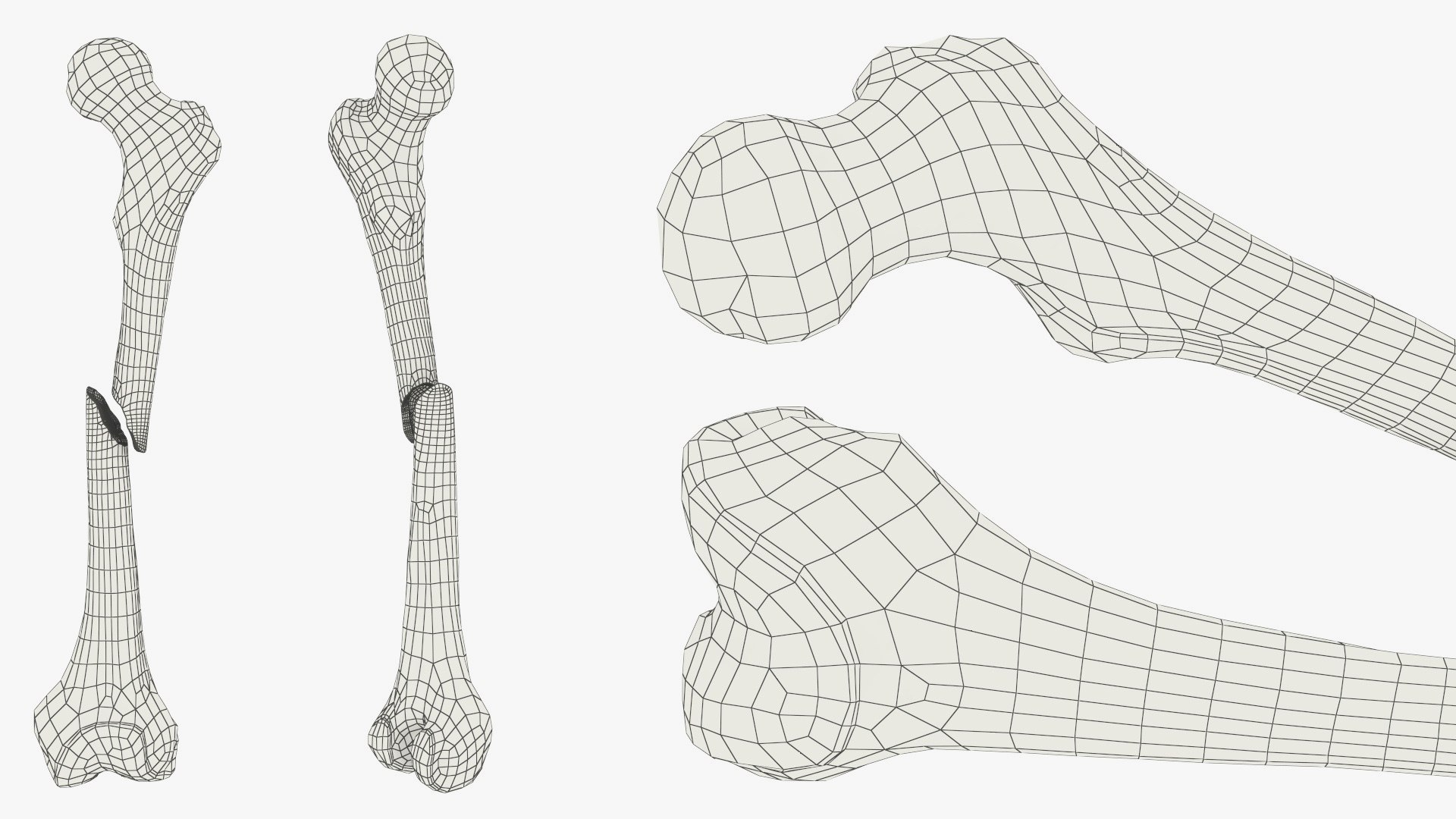 3D Femur Bone with Complete Fracture https://p.turbosquid.com/ts-thumb/9W/uOJLFo/aa/femur_bone_with_complete_fracture_010/jpg/1782799964/1920x1080/fit_q87/ea68b9035c5b90713b77a18a08888a294f6cf4b1/femur_bone_with_complete_fracture_010.jpg