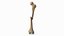 Femur Bone with Complete Fracture