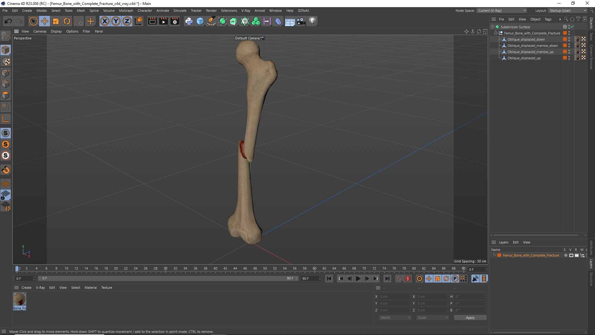 3D Femur Bone with Complete Fracture https://p.turbosquid.com/ts-thumb/9W/uOJLFo/n7/femur_bone_with_complete_fracture_1003/jpg/1782799983/1920x1080/fit_q87/13cb532a5de4c0af4145a0dc0ee833fc711950eb/femur_bone_with_complete_fracture_1003.jpg