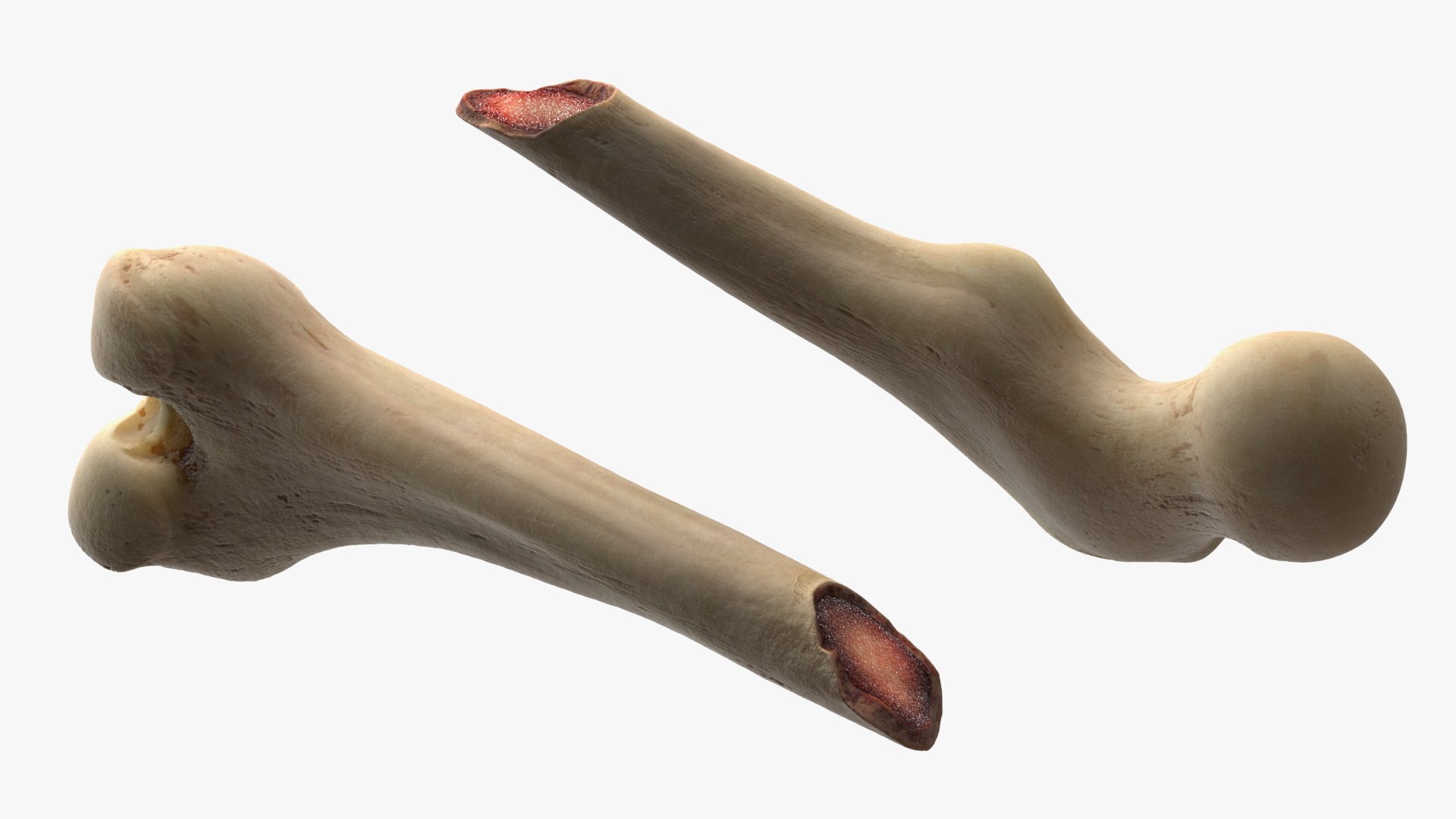 3D Femur Bone with Complete Fracture https://p.turbosquid.com/ts-thumb/9W/uOJLFo/z6/femur_bone_with_complete_fracture_007/jpg/1782799957/1920x1080/fit_q87/ca3a1c9293057b4b2b387bb7b1edcec3e829ac4b/femur_bone_with_complete_fracture_007.jpg