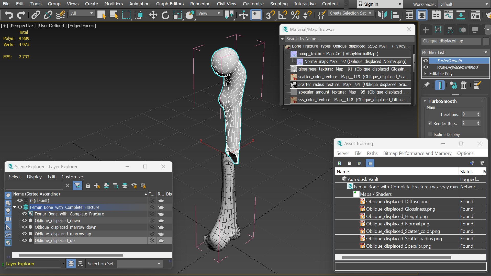 3D Femur Bone with Complete Fracture https://p.turbosquid.com/ts-thumb/9W/uOJLFo/zF/femur_bone_with_complete_fracture_014/jpg/1782799975/1920x1080/fit_q87/a871d70ce99f2dd63451618ecc3c40eef049f085/femur_bone_with_complete_fracture_014.jpg