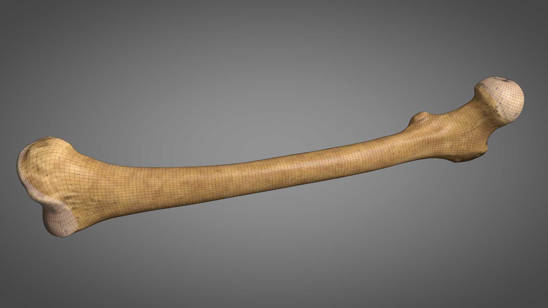 Human femur 3D - TurboSquid 1467752