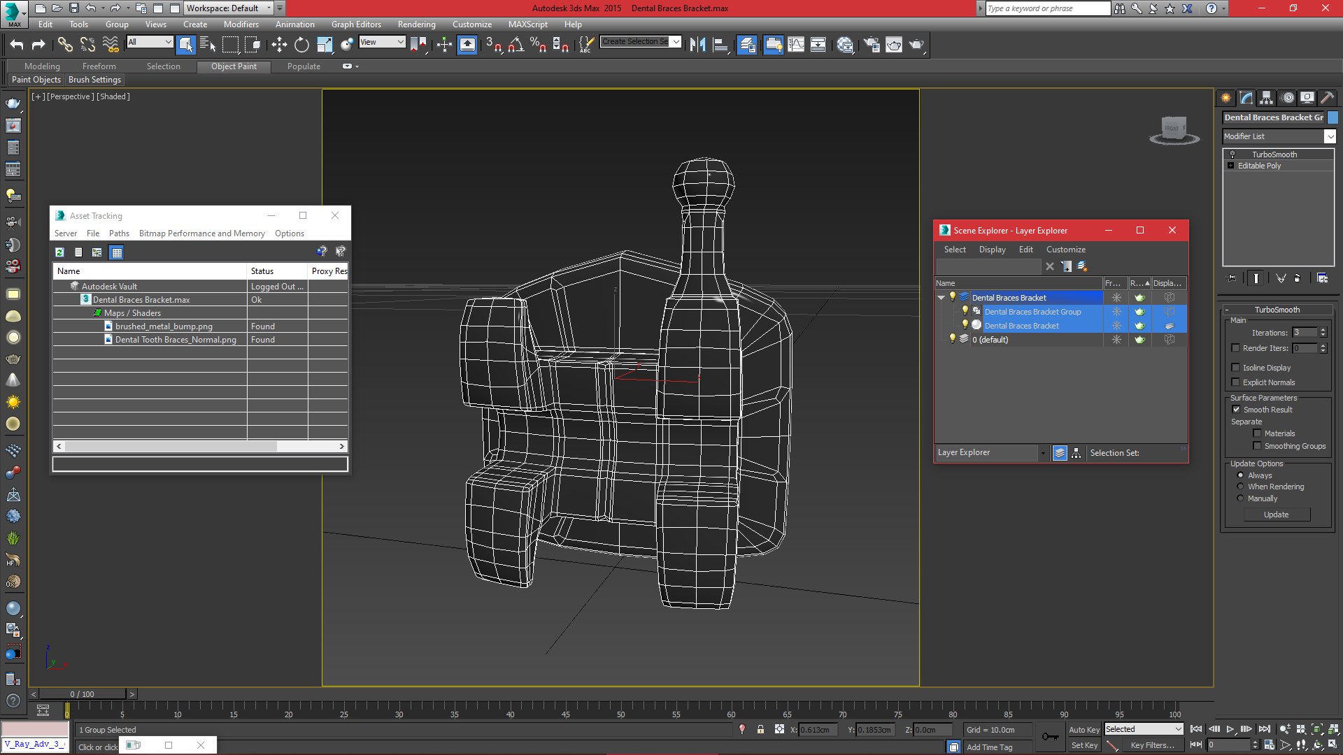 3D Dental Braces Bracket V02 model https://p.turbosquid.com/ts-thumb/9c/qResuA/Ta/dentalbracesbracket_viewport/jpg/1674576589/1920x1080/fit_q87/29c1232002a8da6876c59171b543ed62a789d19e/dentalbracesbracket_viewport.jpg