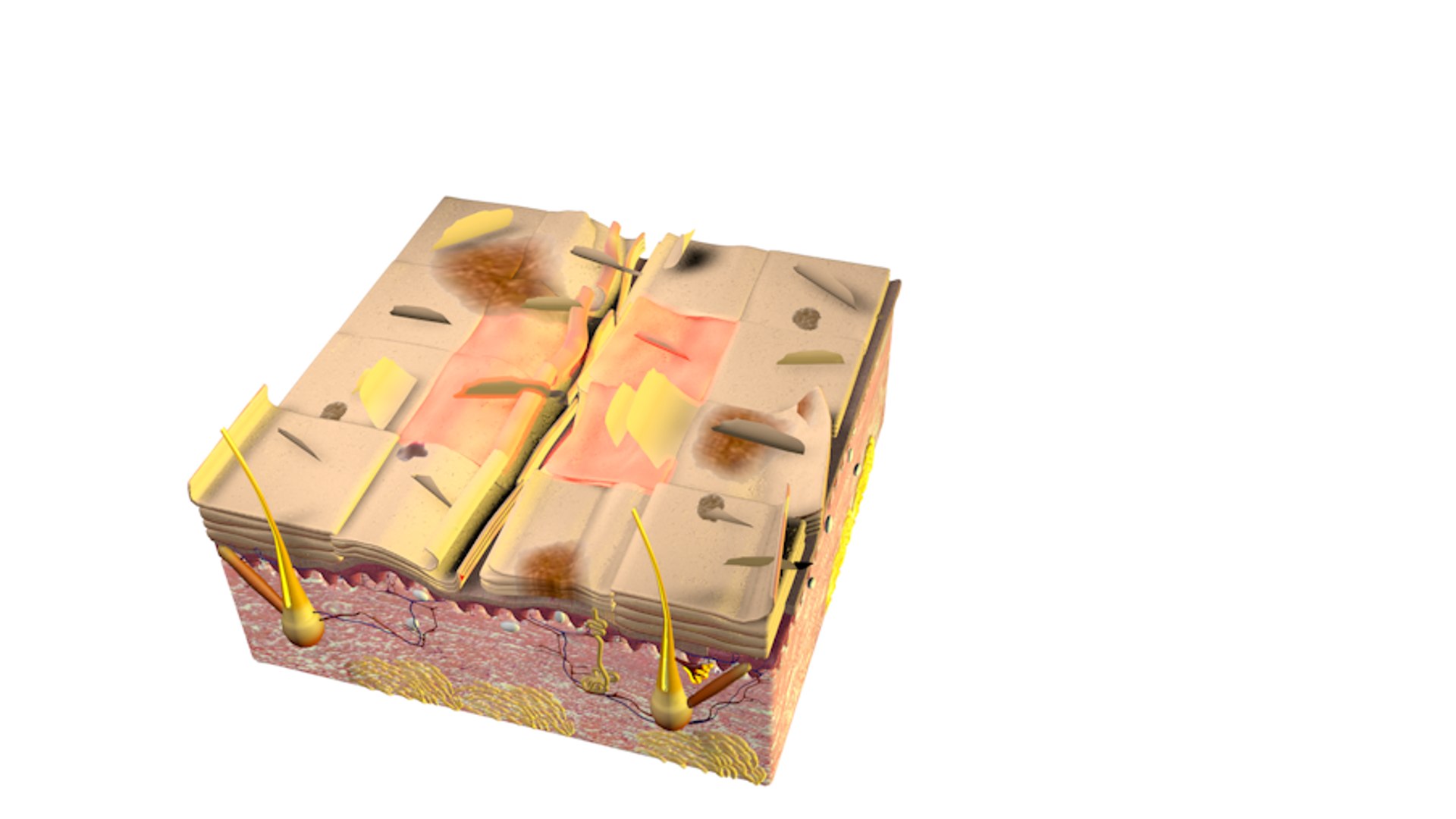 3d model of skin damage