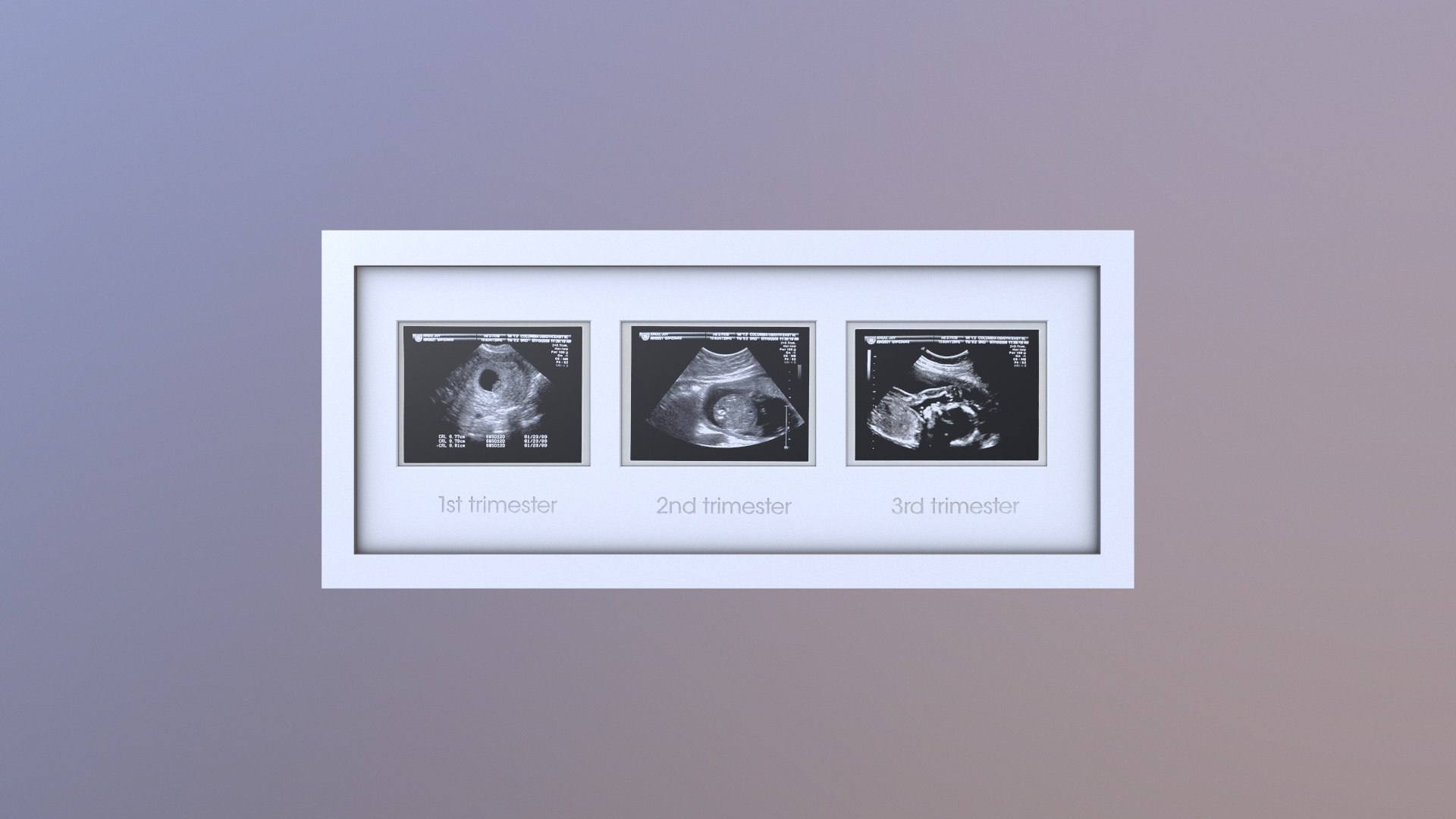 3D Pregnancy Frame Baby Scan Photo Frame TurboSquid 2152083