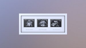 Pregnancy Frame Baby Scan Photo Frame