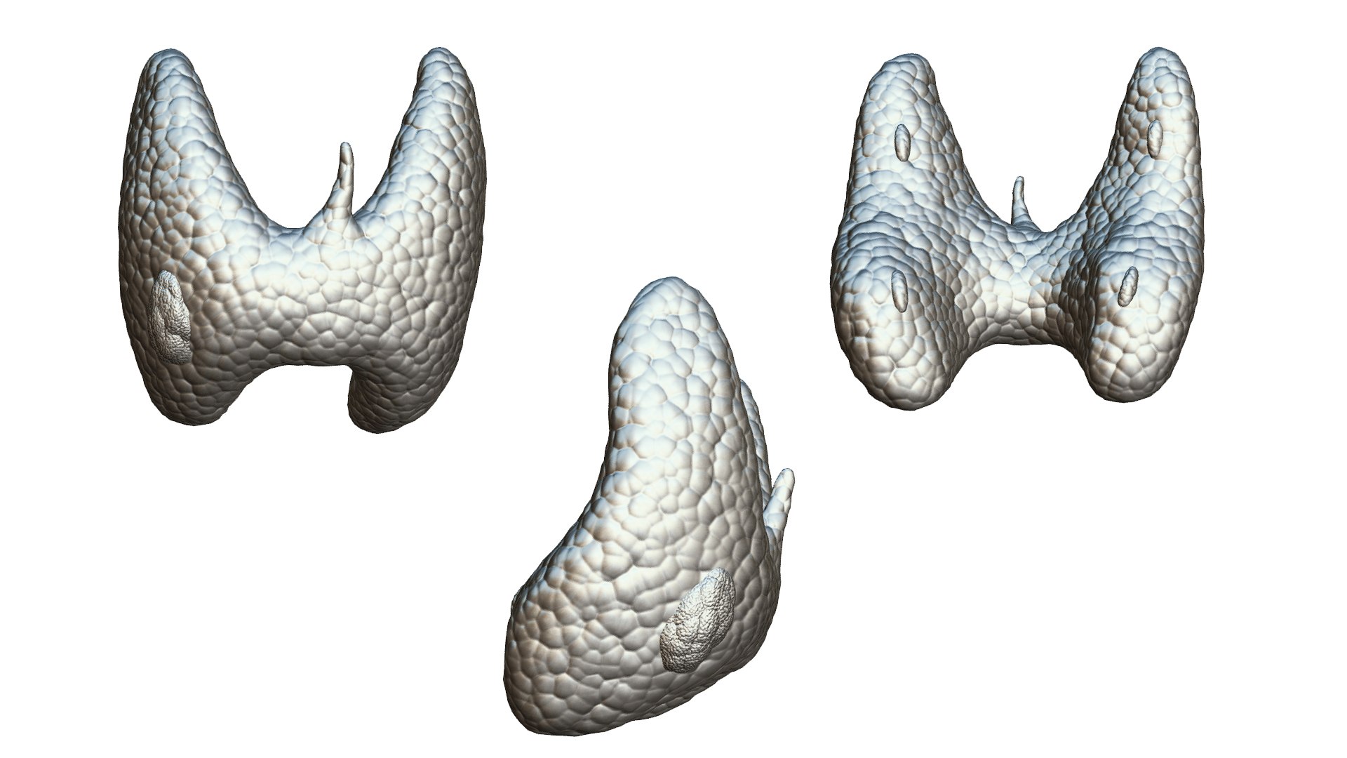 Healthy Thyroid and Thyroid Cancer 3D model https://p.turbosquid.com/ts-thumb/9y/kFilsX/Nf/thyroid_matcap_2/png/1695893917/1920x1080/fit_q87/fb9c2b740c251a2704220728a6dae4fe012405e8/thyroid_matcap_2.jpg