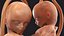 Second Trimester Human Fetus 16 Weeks