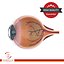 Eye Dissection