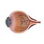Eye Dissection