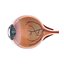 Eye Dissection