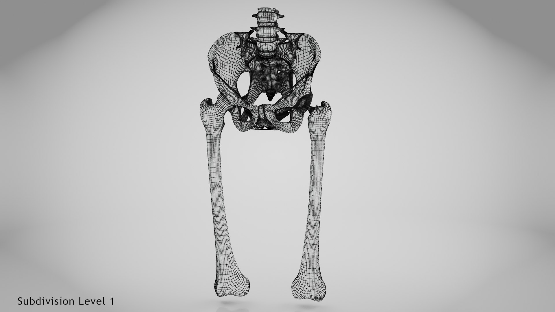 3D Replaced Hip Implant - TurboSquid 2133498