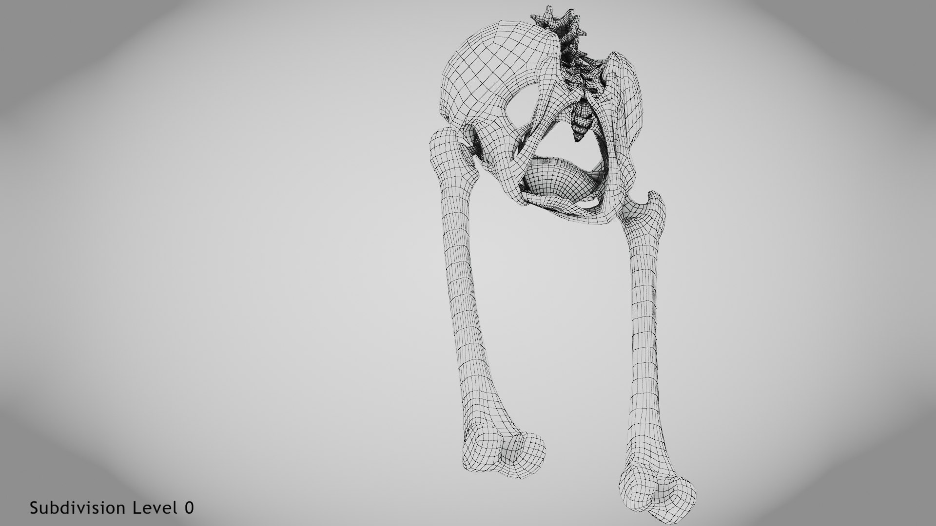 3D Replaced Hip Implant https://p.turbosquid.com/ts-thumb/AU/loYHzG/8I/wire0004copy/jpg/1696274714/1920x1080/fit_q87/886a24d9131cd87dcbc64045d06921457dfdbe6b/wire0004copy.jpg