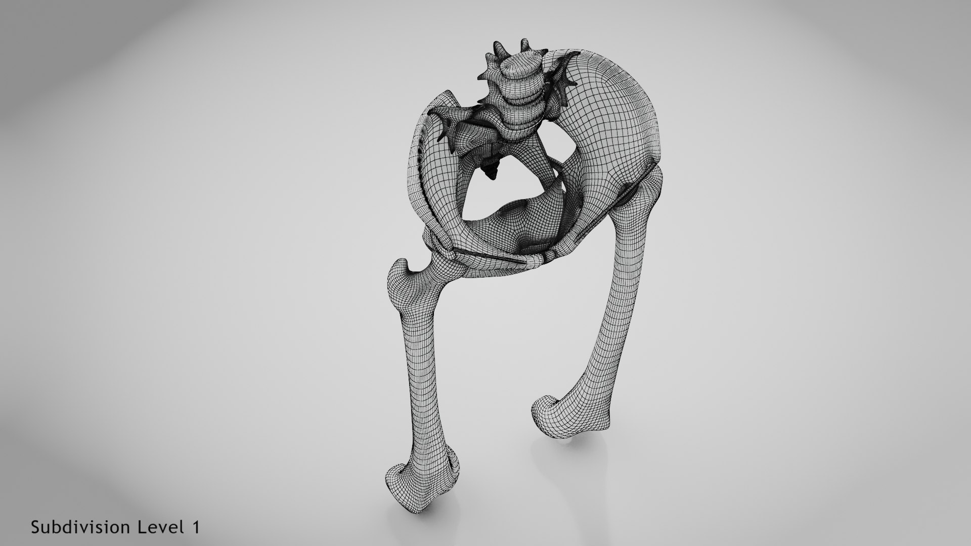 3D Replaced Hip Implant https://p.turbosquid.com/ts-thumb/AU/loYHzG/AX/wire0010/jpg/1696274732/1920x1080/fit_q87/4b3af3eeabfe075fb831fa2e0c483a0f096045db/wire0010.jpg