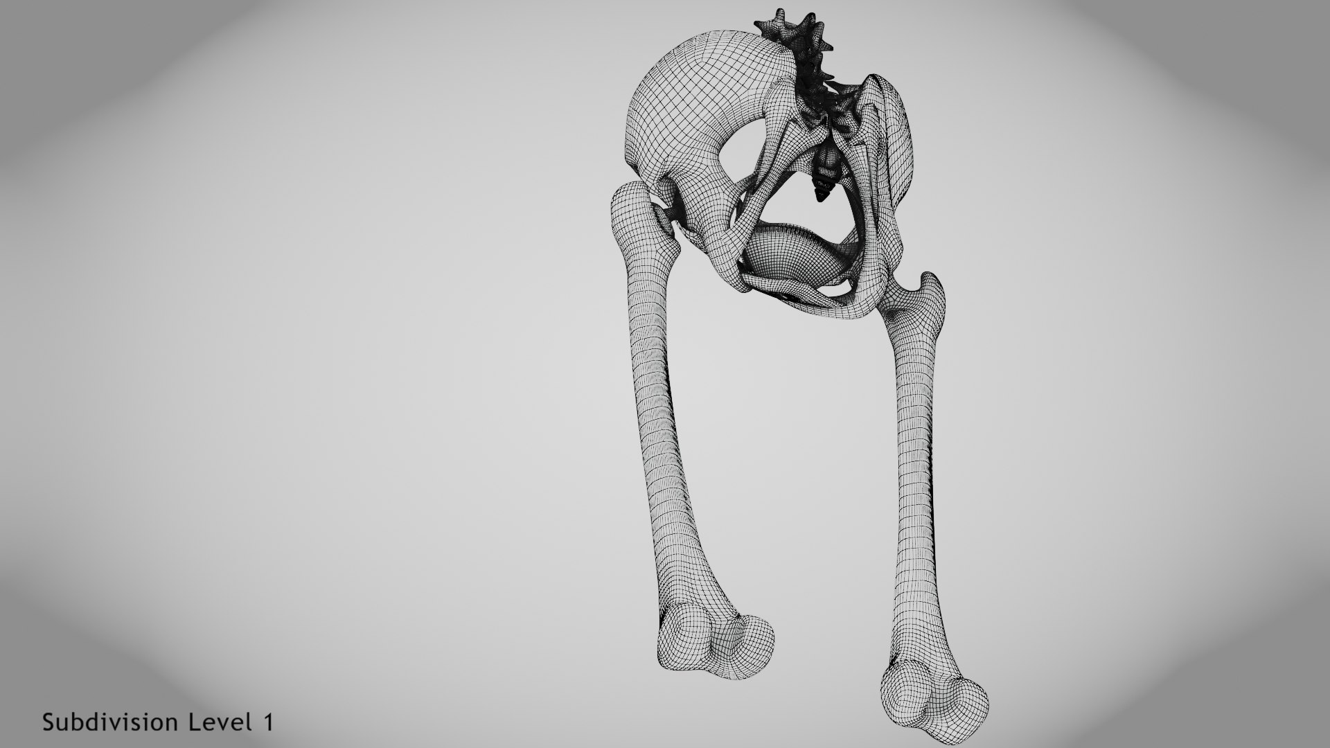 3D Replaced Hip Implant https://p.turbosquid.com/ts-thumb/AU/loYHzG/Nj/wire0004/jpg/1696274716/1920x1080/fit_q87/534beb6876939124afae1476c3454ff6bd370b6f/wire0004.jpg