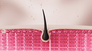 Hair follicle epidermal