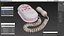 Moniteur de fréquence cardiaque Doppler fœtal