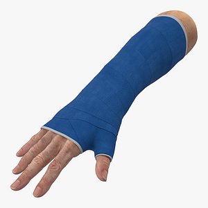 Fiberglass Cast Wrist 3D Model