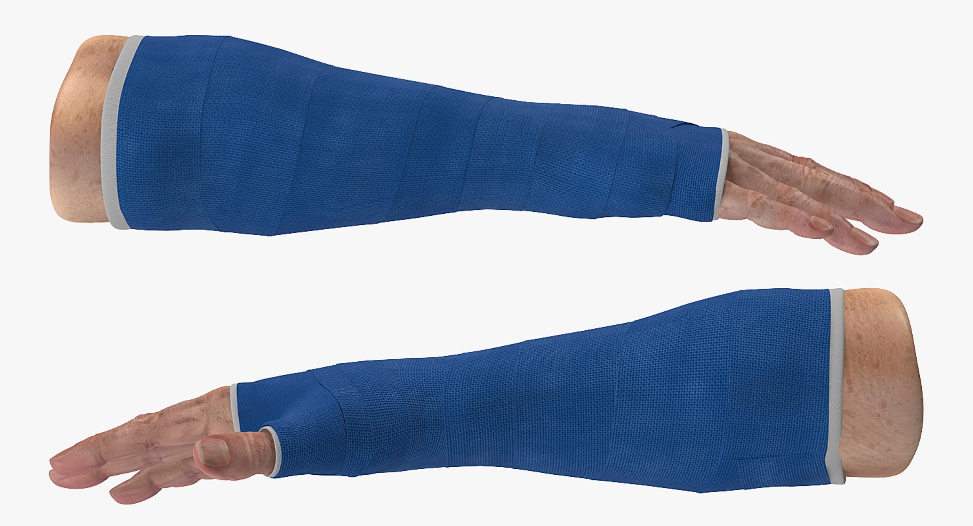 Fiberglass Cast Wrist Model TurboSquid 1230113