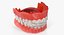 typodont tooth orthodontic retainer model