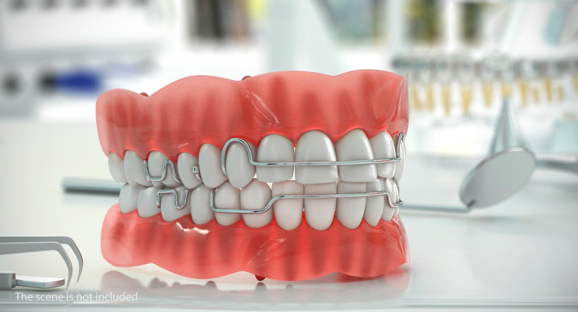 Typodont Tooth Orthodontic Retainer Model TurboSquid 1317820