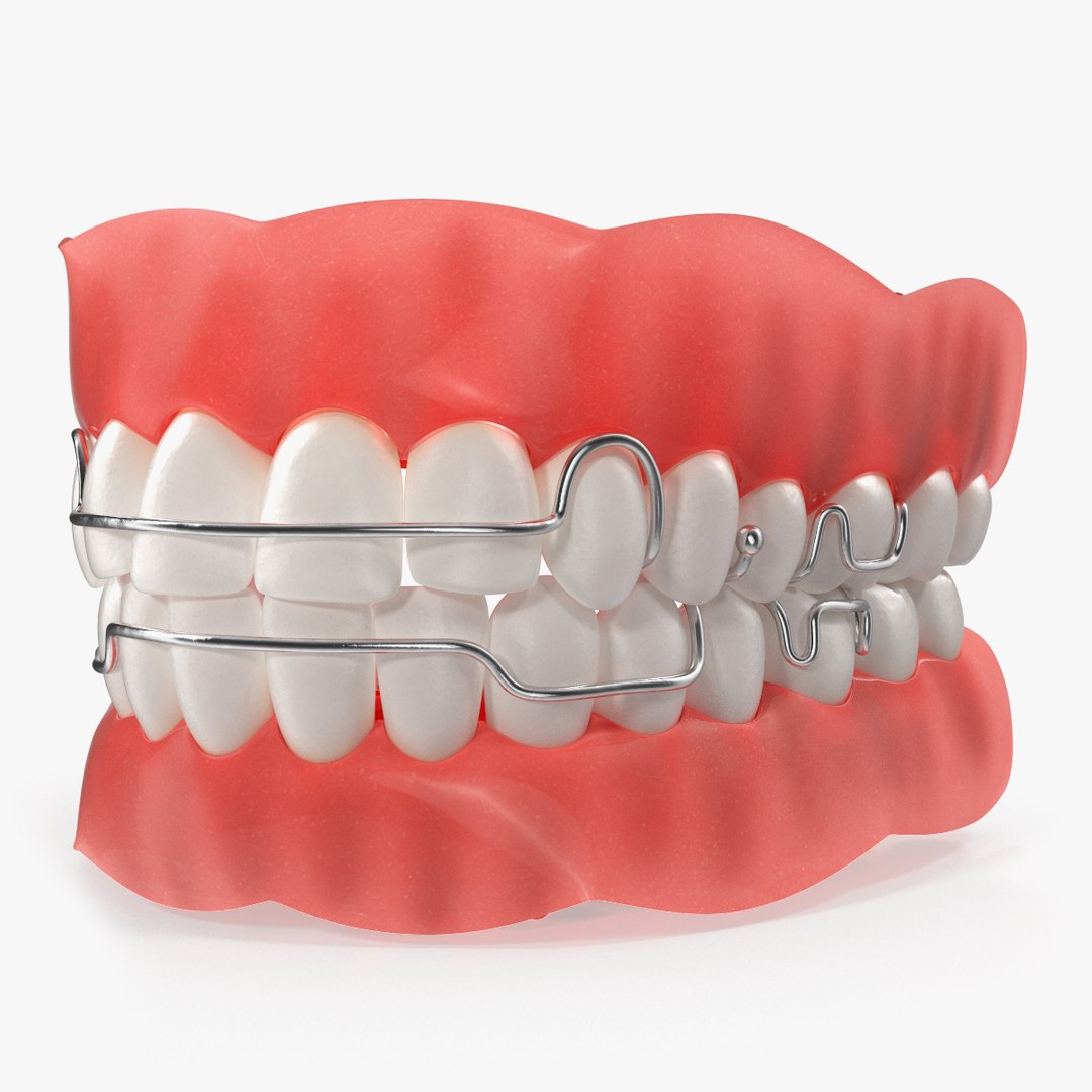 Typodont Tooth Orthodontic Retainer 3D model preview
