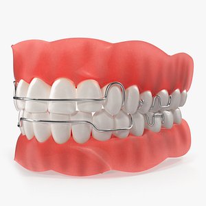 Typodont Tooth Orthodontic Retainer