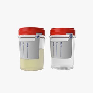Urine Container with Lid Sterile