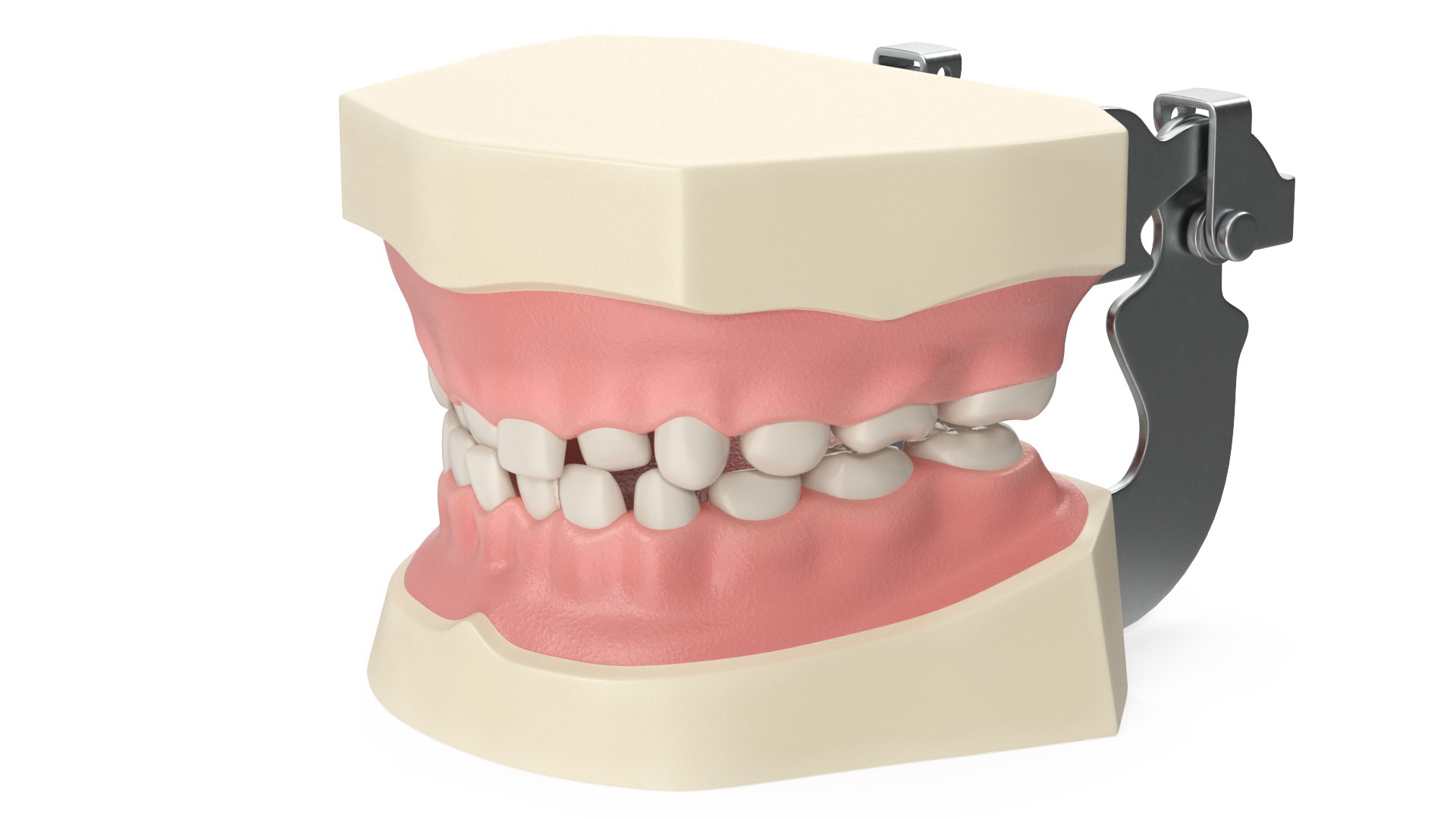 Dental Anatomy Model Simulation with Removable Crossbite Teeth(1) 3D model preview