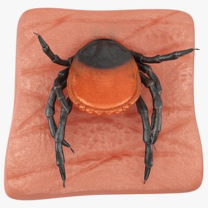 Tick Stuck in Skin