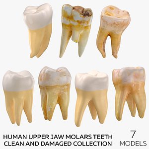 3D Human Upper Jaw Molars Teeth Clean and Damaged Collection - 7 models