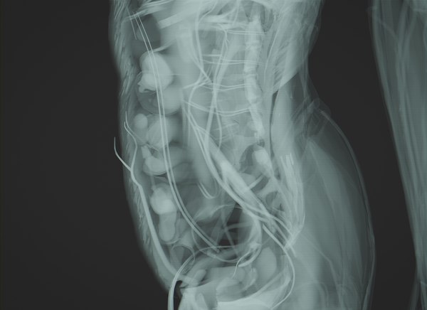 modelo 3d Radiografía de anatomía humana animada - TurboSquid 1815768 modelo 3d Radiografía de anatomía humana animada - TurboSquid 1815768