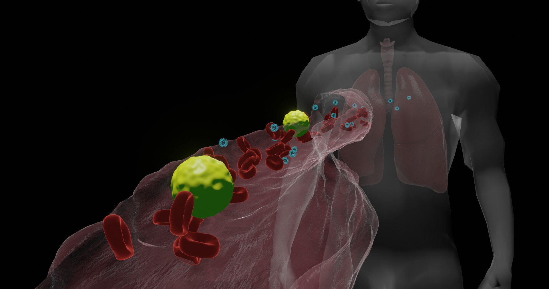 blood vessel corona virus 3D https://p.turbosquid.com/ts-thumb/BN/uzPSpb/PWeCMA3T/lunginfectioncorona20100/jpg/1595164460/1920x1080/fit_q87/a88a30dfdc36028d6e072d7e77676755b9ca674f/lunginfectioncorona20100.jpg