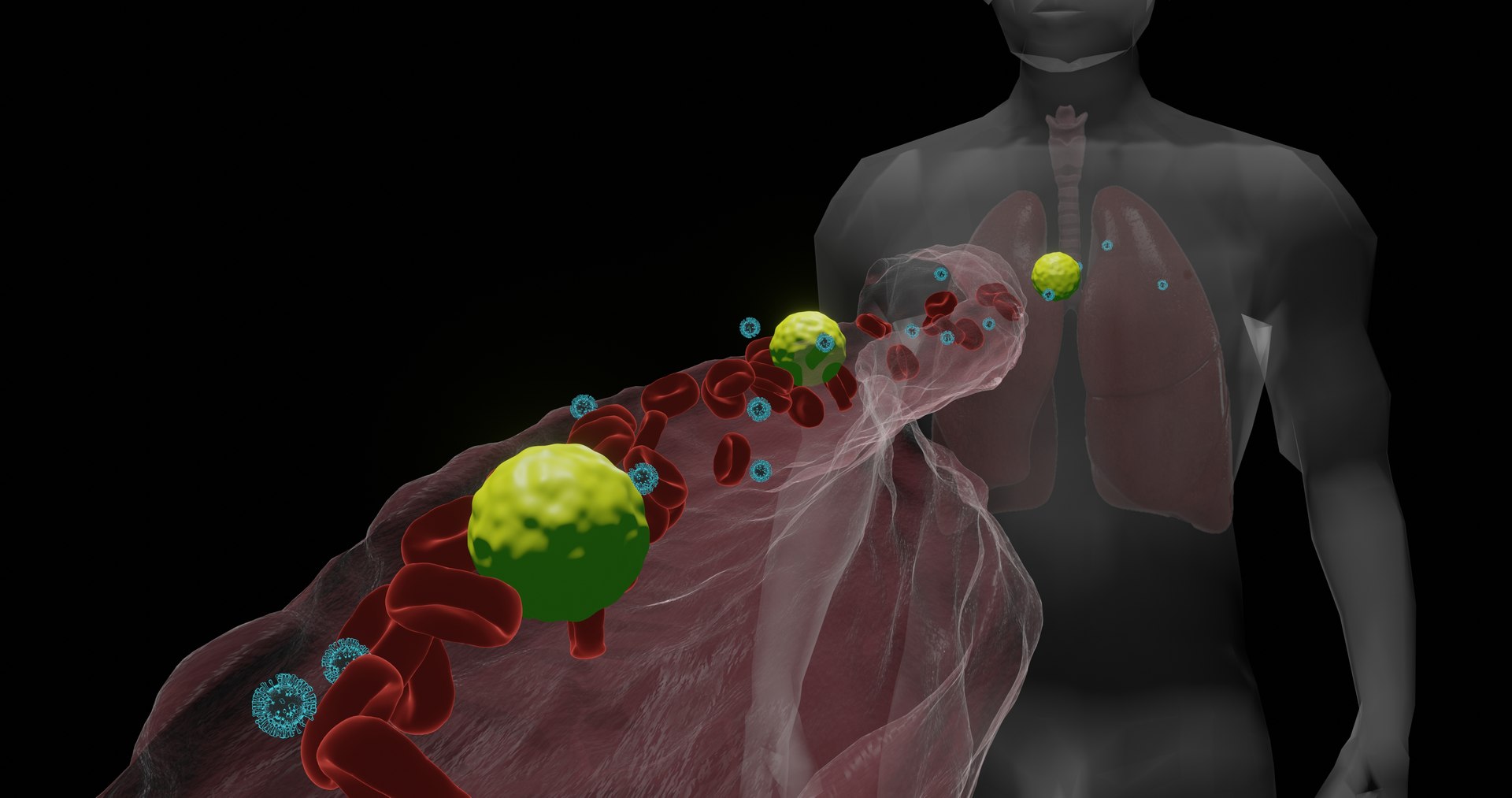 blood vessel corona virus 3D https://p.turbosquid.com/ts-thumb/BN/uzPSpb/edpKAz1V/lunginfectioncorona40201/jpg/1595164503/1920x1080/fit_q87/b4887ea0229fac929a6f348f5c200216f43f1c97/lunginfectioncorona40201.jpg