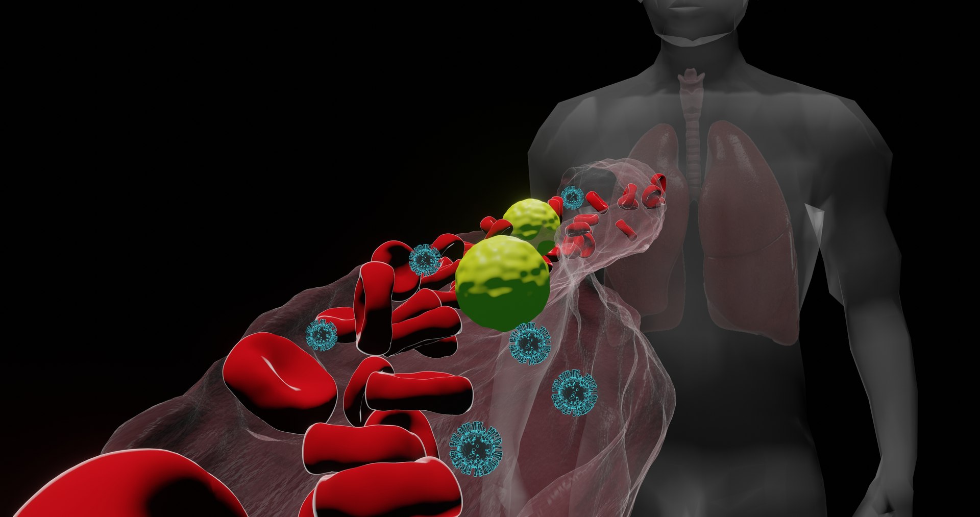 blood vessel corona virus 3D https://p.turbosquid.com/ts-thumb/BN/uzPSpb/iTuD4sZG/coronavirusinfectinglungcells1/jpg/1595164691/1920x1080/fit_q87/5dc042837b42a726b5ef1d4a3248d2c6f585938f/coronavirusinfectinglungcells1.jpg