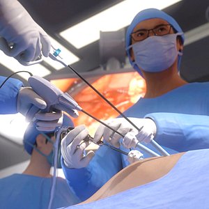Laparoscopy Operation Scene