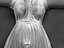 caryatids