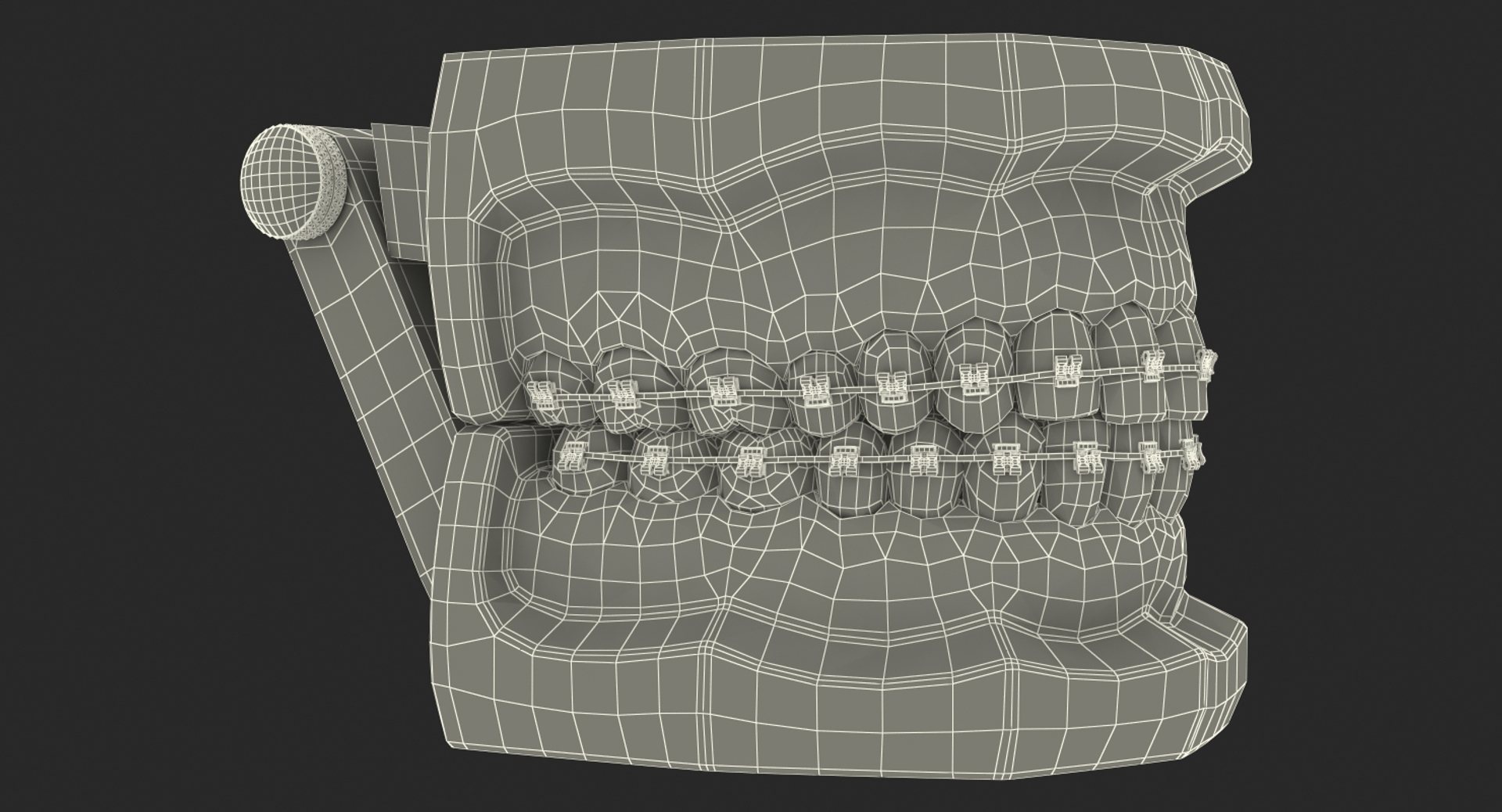 Teeth Mold - 3D Model by dcbittorf