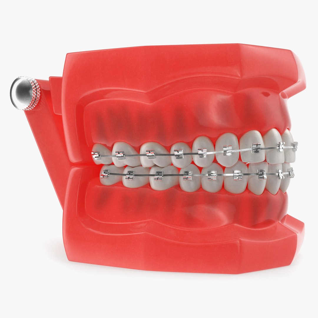 Typodont Teeth Model with Brackets 3D Model 3D model preview