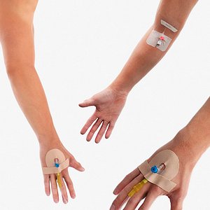 Cannulas with Hand Fixations Collection