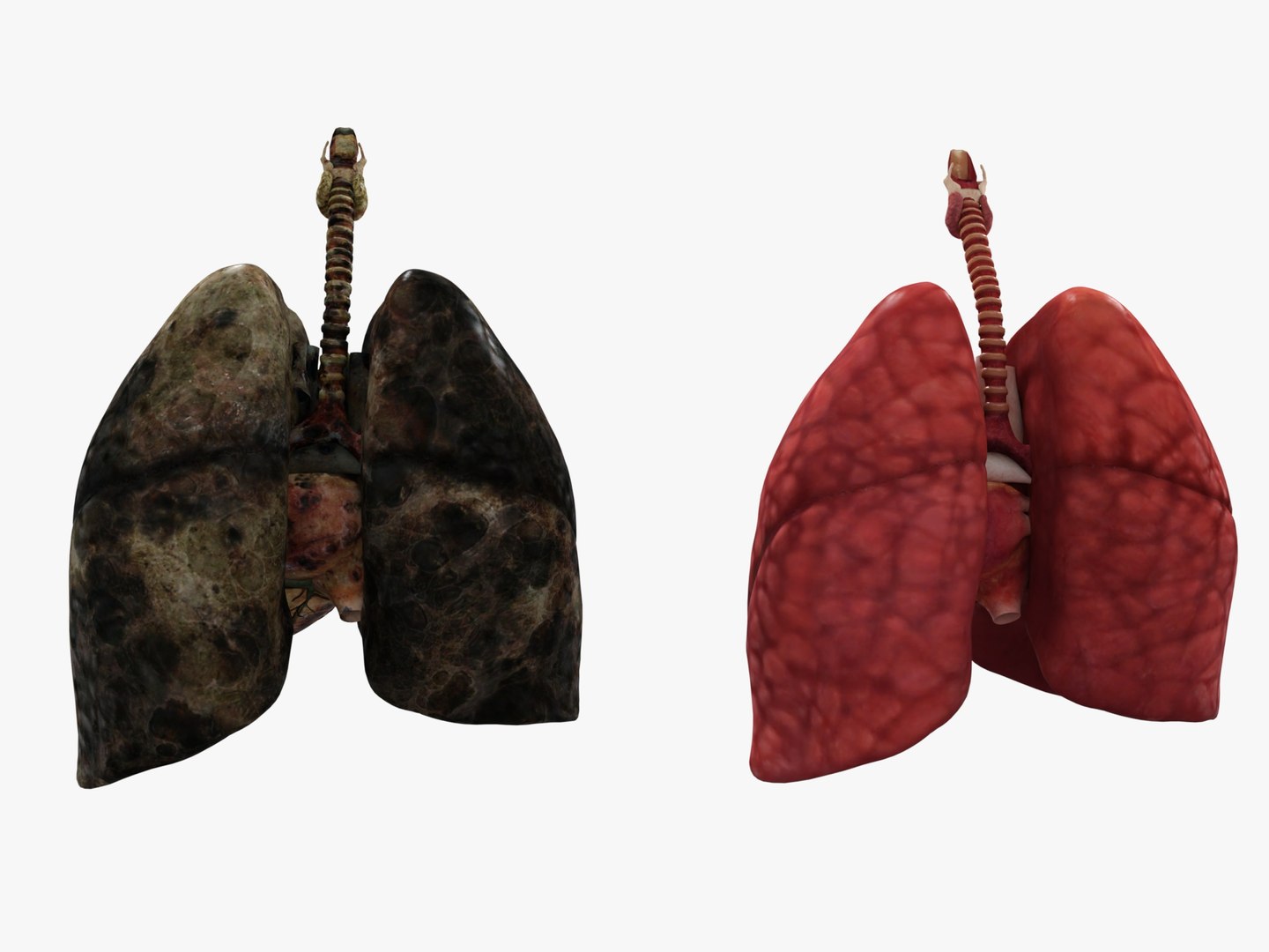 3D Anatomy - Muscle And Organs low-poly 3d model https://p.turbosquid.com/ts-thumb/Bn/Hyc5pD/Zc/healthyunhealthy6/jpg/1768803730/1920x1080/fit_q87/b401fa9e0d24c9ab73b55ae4950244566e755671/healthyunhealthy6.jpg