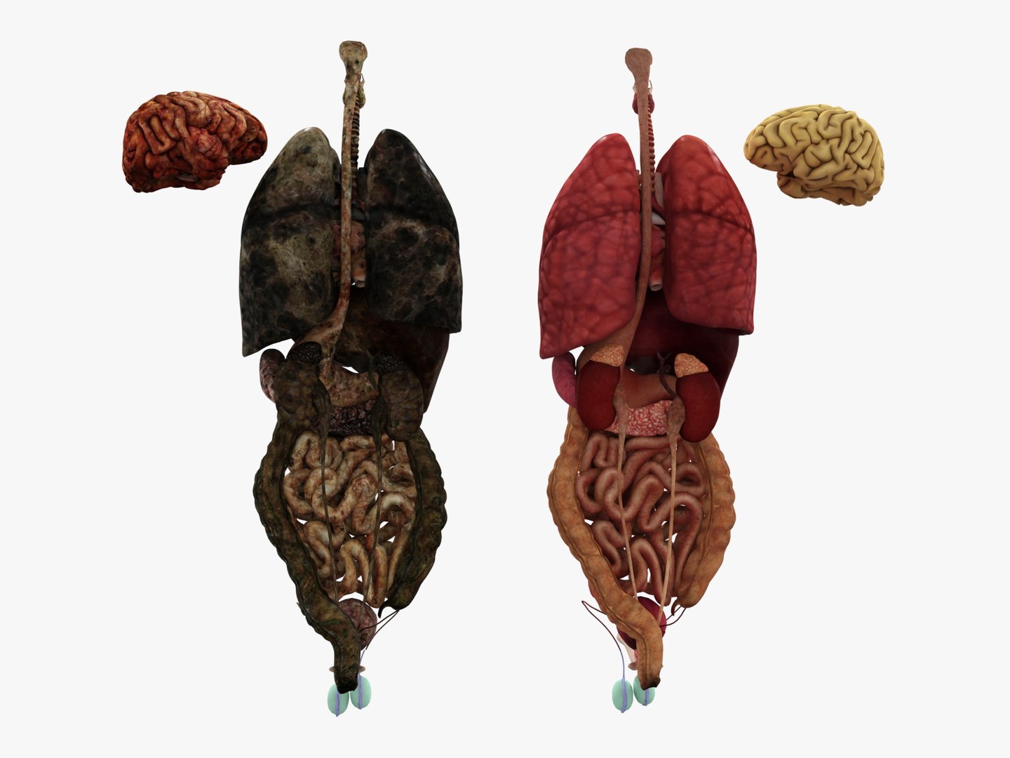 3D Anatomy - Muscle And Organs low-poly 3d model https://p.turbosquid.com/ts-thumb/Bn/Hyc5pD/of/healthyunhealthy2/jpg/1768803728/1920x1080/fit_q87/d83c27a8fdc8f49202d879c100d9212c86b84119/healthyunhealthy2.jpg