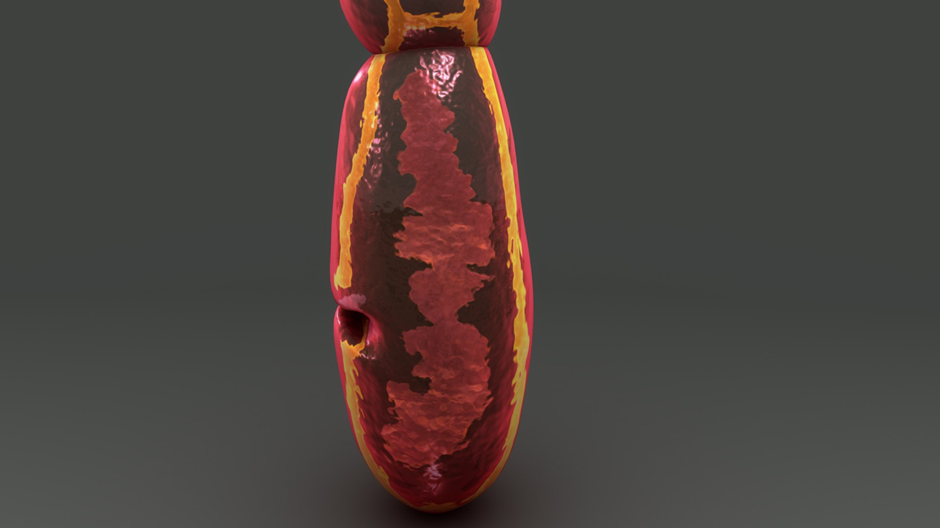 Echinococcus Granulosus 3d Model