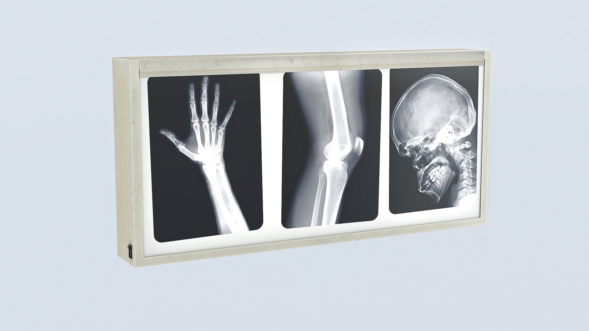 hospital vintage pack model https://p.turbosquid.com/ts-thumb/CI/v5bZEM/Bq/xray02/jpg/1706298713/1920x1080/fit_q87/a9afa6dec2cf0dea6ae384d3d3e4c95e876f9550/xray02.jpg